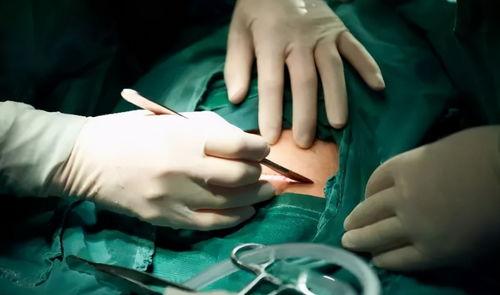 剖腹产后吃生瓜,生瓜的神奇功效与食用指南